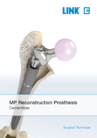 MP Reconstruction Prosthesis - uncemented