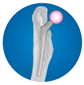 Icon: Hip Stem