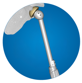 Icon: Humerus