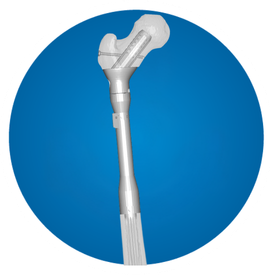 Icon: Proximal femur replacement