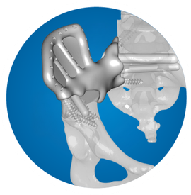 Icon: SI joint