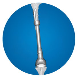 Icon: Distal Femoral
